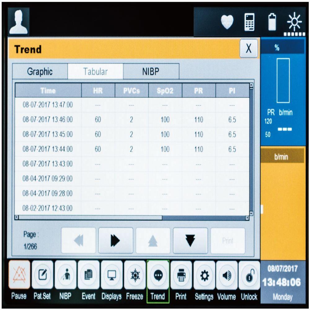 Patient Monitor System (BT-770)